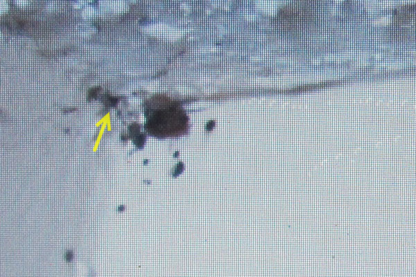 bed bug infestation in ceiling